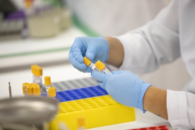 Sobe para 35 número de casos confirmados de covid-19 em Campo Maior PI 