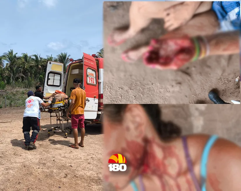 Foto: Reprodução