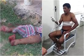 Homem tem o pé decepado após briga de facão no litoral do Piauí