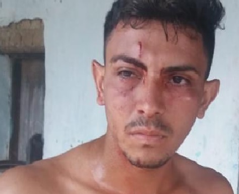Jovem é esfaqueado no Piauí ao proteger a irmã, que era espiada no banho