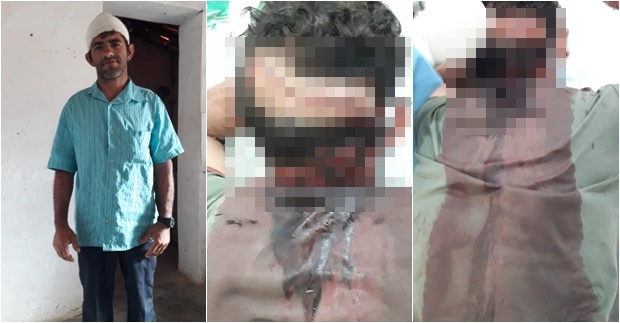 PI: homem é atingido com golpes de foice na cabeça e tio é apontado como autor do crime