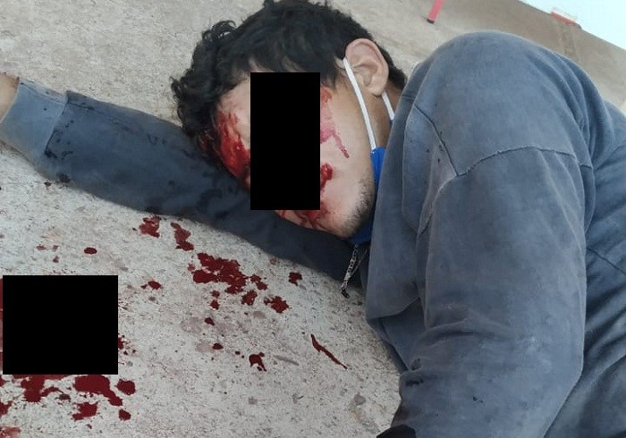 Jovem fica ferido durante colisão entre moto e carro na PI-113, em José de Freitas