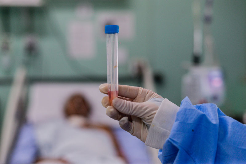 Com mais 15 mortes, Piauí tem quase 60% dos municípios com óbitos por covid-19