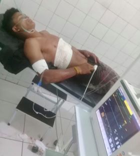 Família pede Justiça: Homem esfaqueia jovem e continua em liberdade fazendo ameaças na zona rural de Barras PI 