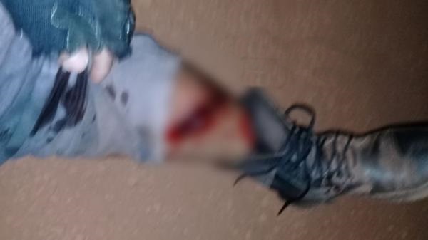 Vítima vinha da região da Formosa para a zona urbana de Piripiri quando foi baleado