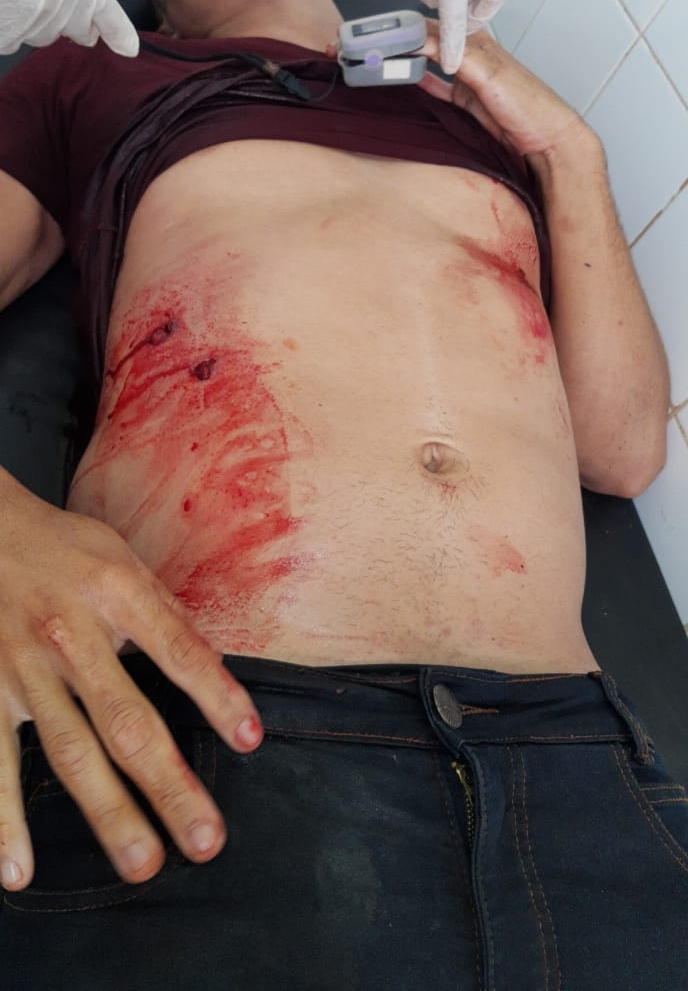 Assaltante é baleado no Centro de Barras PI 