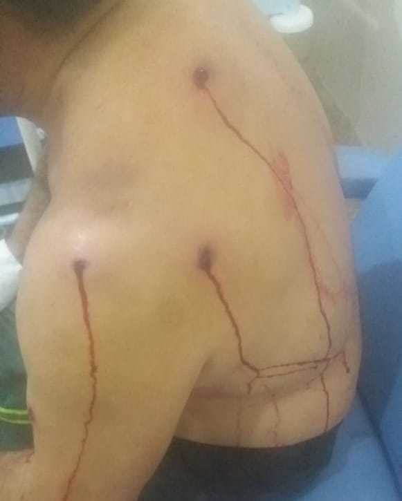 Vendedor de gás é baleado várias vezes em tentativa de latrocínio no Piauí