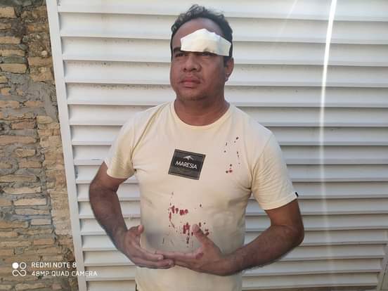 Jornalista dono do Portal Agrandebarras é vítima de assalto e agressões na porta de casa em Barras PI 
