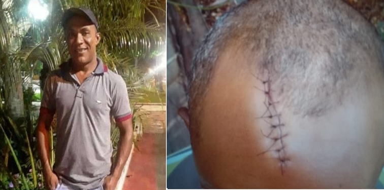 Homem é esfaqueado na cabeça, tem alta médica e morre no interior do Piauí
