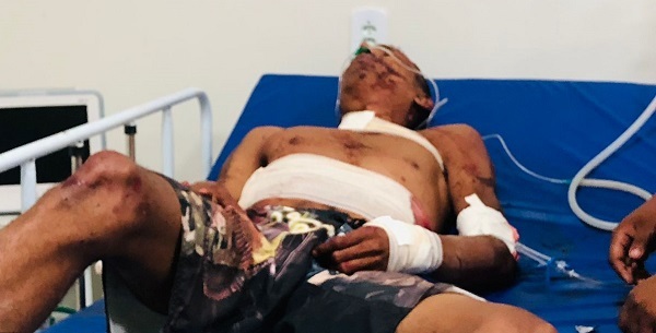 Jovem sobrevive a 12 facadas após conflito com dupla armada em cidade do Piauí