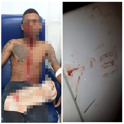 Teresina PI: Tiroteio termina com bandido alvejado no olho