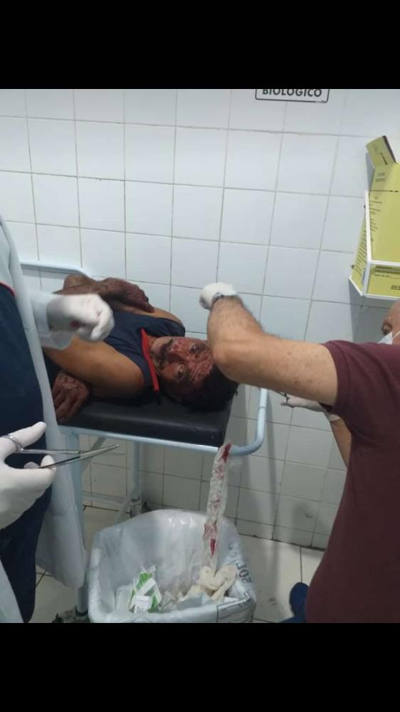 Mecânico é fortemente agredido por mulher em Barras PI