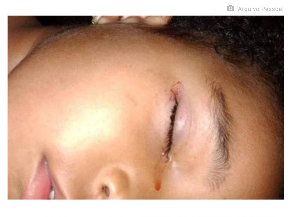 Sangue provocado pelo ataque Reprodução/Redes sociais