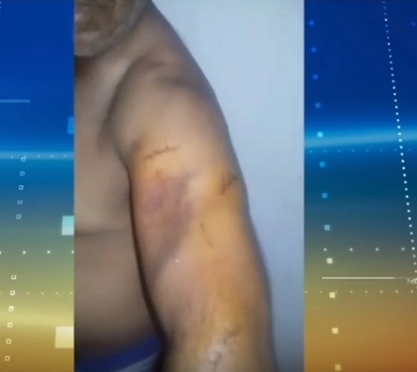 Mototaxista é esfaqueado durante assalto na zona Sul de Teresina