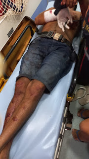 CONFUSÃO EM BAR DEIXA UM HOMEM BALEADO E DUAS MULHERES FERIDAS EM BARRAS PI