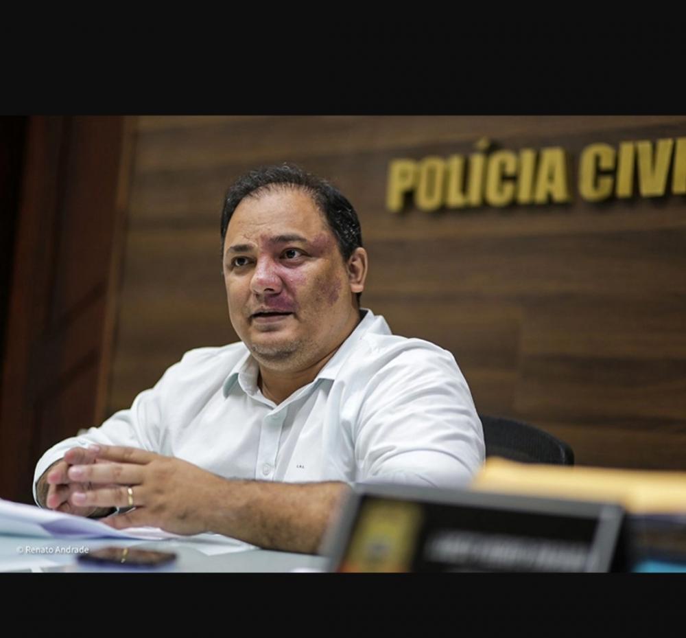 Foto: Renato Andrade / Cidadeverde.com