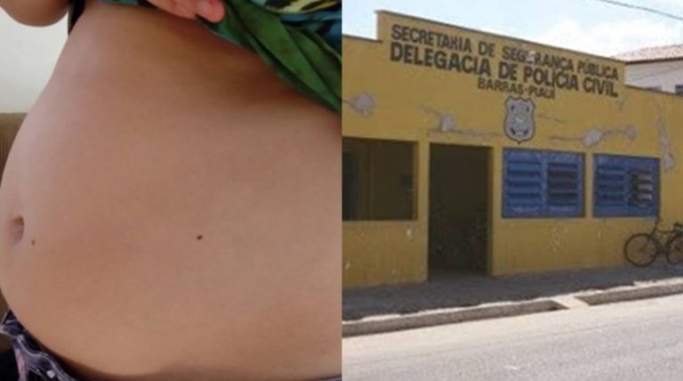Barras PI: Polícia deve solicitar DNA para comprovar abuso da criança de 10 anos que engravidou