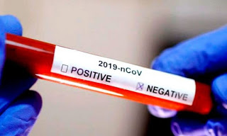 Elesbão Veloso registra primeiro caso positivo par COVID-19