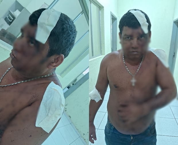 Reprodução