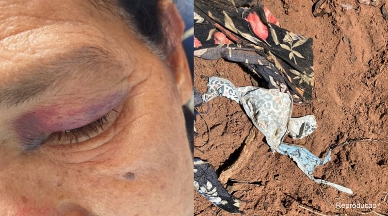 Idosa é espancada e estuprada por dois adolescentes em matagal no Piauí / Foto - Reprodução